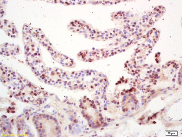Formalin-fixed and paraffin embedded mouse intestine labeled with Rabbit Anti RNF36 Polyclonal Antibody, Unconjugated (bs-7569R) at 1:200 followed by conjugation to the secondary antibody and DAB staining