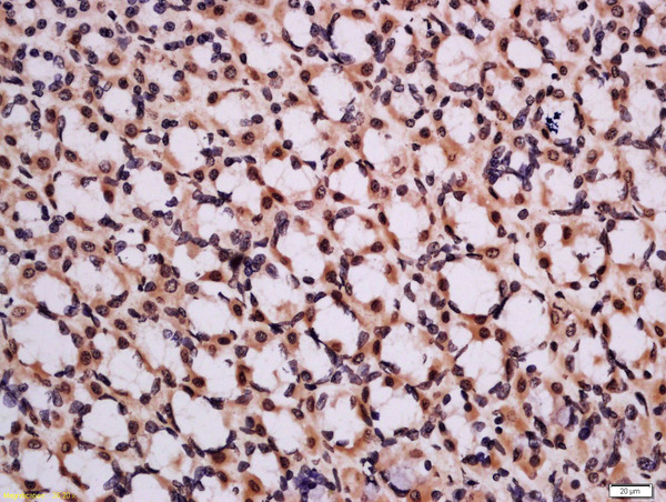 Formalin-fixed and paraffin embedded rat stomach tissue labeled with Rabbit Anti-CHMP2A Polyclonal Antibody, Unconjugated (bs-13913R) at 1:200 followed by conjugation to the secondary antibody and DAB staining