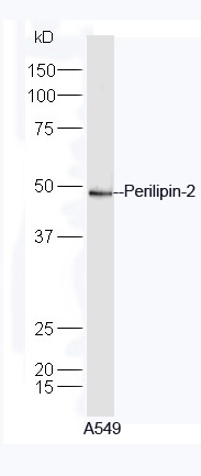 A549 lysate probed with Rabbit Anti-Perilipin 2 Polyclonal Antibody, Unconjugated (bs-10780R) at 1:300 in 4˚C overnight. Followed by conjugation to secondary antibody (bs-0295G-HRP) at 1:5000 for 90min at 37˚C.