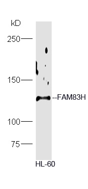 HL-60 lysate probed with Rabbit Anti-FAM83H Polyclonal Antibody, Unconjugated (bs-16018R) at 1:300 in 4˚C overnight. Followed by conjugation to secondary antibody (bs-0295G-HRP) at 1:5000 for 90min at 37˚C.