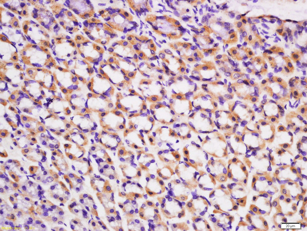 Formalin-fixed and paraffin embedded rat stomach labeled with Rabbit Anti-ACVR2B/ACTR-IIB Polyclonal Antibody, Unconjugated (bs-12417R) at 1:200 followed by conjugation to the secondary antibody and DAB staining\n