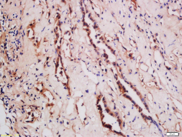 Formalin-fixed and paraffin embedded human kidney labeled with Rabbit Anti-TNFSF15 Polyclonal Antibody, Unconjugated (bs-5092R) at 1:200 followed by conjugation to the secondary antibody and DAB staining\n