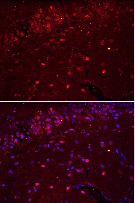 Formalin-fixed and paraffin embedded rat brain labeled with Rabbit Anti-AIF1 Polyclonal Antibody, Unconjugated (bs-1363R) at 1:200 followed by conjugation to the secondary antibody Goat Anti-Rabbit IgG, Cy3 conjugated(bs-0295G-Cy3)used at 1:200 dilution for 40 minutes at 37\u00b0C.\\n
