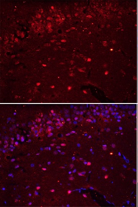 Formalin-fixed and paraffin embedded rat brain labeled with Rabbit Anti-AIF1 Polyclonal Antibody, Unconjugated (bs-1363R) at 1:200 followed by conjugation to the secondary antibody Goat Anti-Rabbit IgG, Cy3 conjugated(bs-0295G-Cy3)used at 1:200 dilution for 40 minutes at 37°C.\n