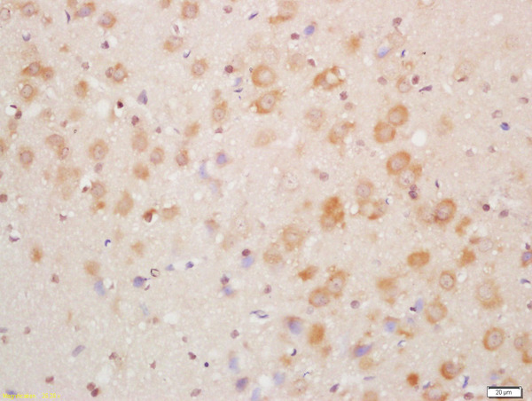 Formalin-fixed and paraffin embedded mouse brain labeled with Rabbit Anti-NDUFA8 Polyclonal Antibody, Unconjugated (bs-3958R) at 1:200 followed by conjugation to the secondary antibody and DAB staining