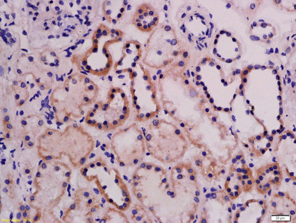 Formalin-fixed and paraffin embedded rat kidney labeled with Rabbit Anti-ABI3 Polyclonal Antibody, Unconjugated (bs-5985R) at 1:200 followed by conjugation to the secondary antibody and DAB staining
