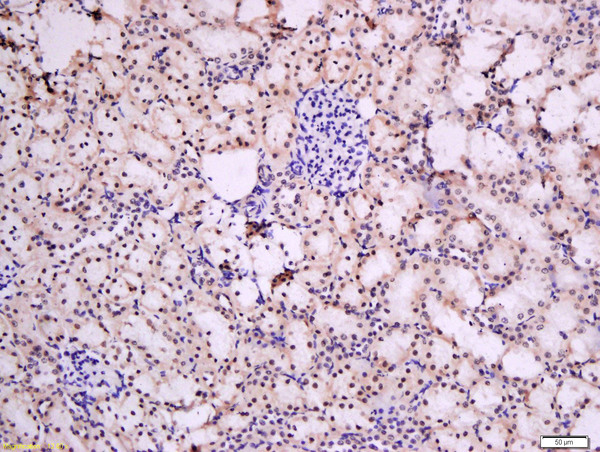 Formalin-fixed and paraffin embedded rat kidney tissue labeled with Rabbit Anti-Urocortin 3 Polyclonal Antibody, Unconjugated (bs-2786R) at 1:200 followed by conjugation to the secondary antibody and DAB staining