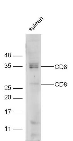 Mouse spleen lysate probed with Anti-CD8 Polyclonal Antibody (bs-0648R) at 1:300 overnight in 4˚C. Followed by conjugation to the secondary antibody (bs-0295G-HRP) at 1:5000 90min in 37˚C.