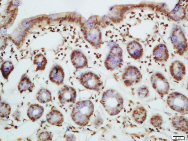 Formalin-fixed and paraffin embedded mouse intestine labeled with Rabbit Anti-Bim(Ser87) Polyclonal Antibody, Unconjugated (bs-3012R) at 1:200 followed by conjugation to the secondary antibody and DAB staining\n