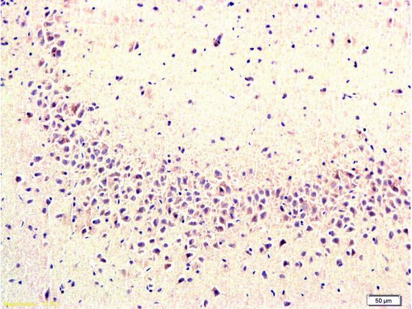 Formalin-fixed and paraffin embedded rat brain labeled with  Rabbit Anti Cyclooxygenase 2\/COX2 Polyclonal Antibody, Unconjugated (bs-0732R) at 1:200 followed by conjugation to the secondary antibody and DAB staining