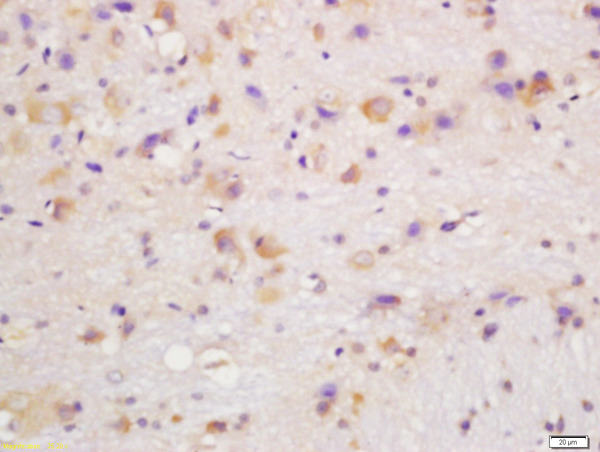 Formalin-fixed and paraffin embedded mouse brain labeled with Rabbit Anti-CYP24A1 Polyclonal Antibody, Unconjugated (bs-3899R) at 1:200 followed by conjugation to the secondary antibody and DAB staining\n