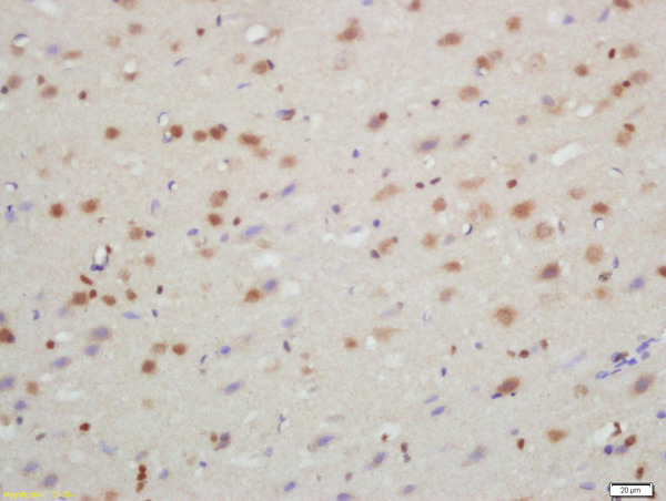 Formalin-fixed and paraffin embedded rat brain labeled with Rabbit Anti-TXNIP Polyclonal Antibody, Unconjugated (bs-3897R) at 1:200 followed by conjugation to the secondary antibody and DAB staining\n