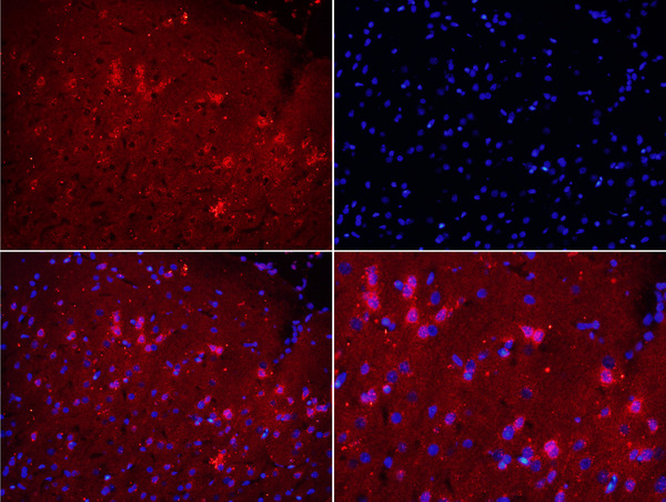 Formalin-fixed and paraffin embedded rat brain labeled with Rabbit Anti-NOX2/gp91phox Polyclonal Antibody, Unconjugated (bs-3889R) at 1:200 followed by conjugation to the secondary antibody Goat Anti-Rabbit IgG, Cy3 conjugated(bs-0295G-Cy3)used at 1:200 dilution for 40 minutes at 37°C.
