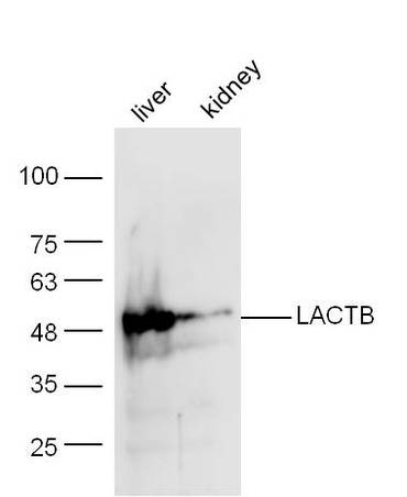 Mouse liver/kidney lysates probed with Anti-LACTB Polyclonal Antibody (bs-16882R) at 1:300 overnight in 4˚C. Followed by conjugation to the secondary antibody (bs-0295G-HRP) at 1:5000 90min in 37˚C.