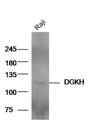 Raji cell lysates probed with Anti-DGKH Polyclonal Antibody (bs-14298R) at 1:300 overnight in 4˚C. Followed by conjugation to the secondary antibody (bs-0295G-HRP) at 1:5000 90min in 37˚C.