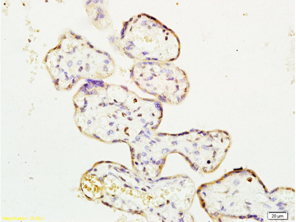 Formalin-fixed and paraffin embedded human placenta labeled with Rabbit Anti ERK1/MAPK3 Polyclonal Antibody, Unconjugated (bs-1020R) at 1:200 followed by conjugation to the secondary antibody and DAB staining