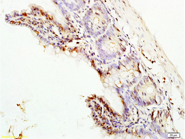 Formalin-fixed and paraffin embedded rat colon labeled with  Rabbit Anti ERK1\/MAPK3 Polyclonal Antibody, Unconjugated (bs-1020R) at 1:200 followed by conjugation to the secondary antibody and DAB staining