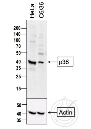 Independently Validated Antibody, image provided by Science Exchange, badge number 029806: L1 HeLa cell lysate, L2 C6/36 cell lysates probed with Anti-P38 MAPK Polyclonal Antibody, Unconjugated (bs-0637R) at 1:500 overnight at 4˚C. Followed by conjugation to secondary antibody at 1:100000 for 90 min at 37˚C. Predicted band 41kDa. A strong band was observed in the positive control sample at the correct molecular weight.