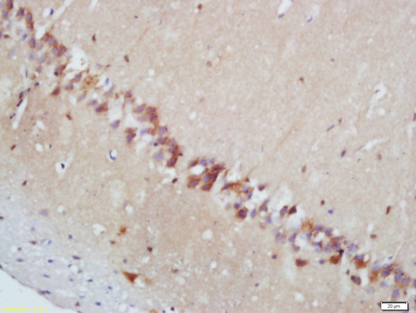 Formalin-fixed and paraffin embedded mouse brain labeled with Rabbit Anti-MAPKAPK2 (Thr222) Polyclonal Antibody, Unconjugated (bs-3261R) at 1:200 followed by conjugation to the secondary antibody and DAB staining\\n
