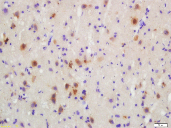 Formalin-fixed and paraffin embedded rat brain labeled with Rabbit Anti-MKK3(Ser218)/MKK6(Ser207) Polyclonal Antibody, Unconjugated (bs-3274R) at 1:200 followed by conjugation to the secondary antibody and DAB staining\n