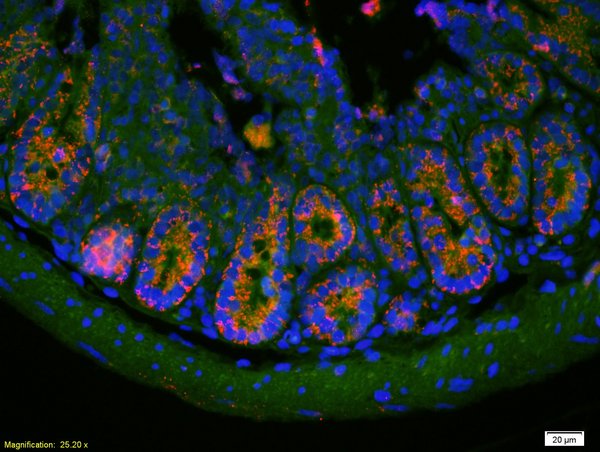 Formalin-fixed and paraffin-embedded mouse intestine labeled with Anti-PAI1/PLANH1/Serpine 1 Polyclonal Antibody, Unconjugated(bs-6562R) 1:200, overnight at 4°C, The secondary antibody was Goat Anti-Rabbit IgG, Cy3 conjugated(bs-0295G-Cy3)used at 1:200 dilution for 40 minutes at 37°C.DAPI was used to stain the cell nuclei