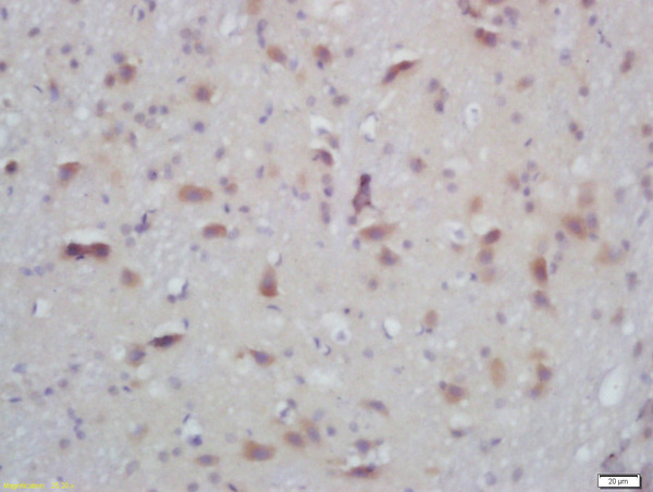 Formalin-fixed and paraffin embedded mouse brain labeled with Rabbit Anti-PKC alpha/beta II (Thr638/641) Polyclonal Antibody, Unconjugated (bs-3333R) at 1:200 followed by conjugation to the secondary antibody and DAB staining\n