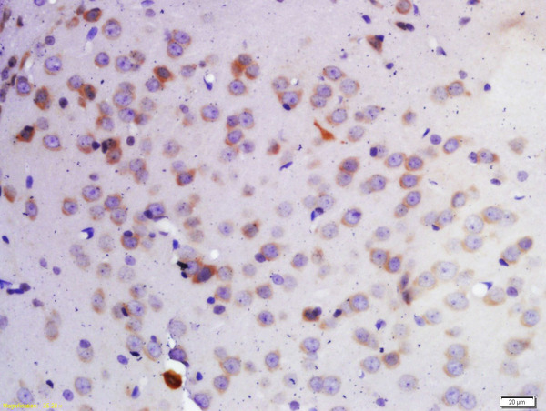 Formalin-fixed and paraffin embedded rat brain labeled with Rabbit Anti-KDM1 Polyclonal Antibody, Unconjugated(bs-3821R) 1:200 followed by conjugation to the secondary antibody and DAB staining