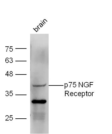 Mouse brain lysates probed with Anti-p75 NGF Receptor Polyclonal Antibody (bs-0161R) at 1:300 overnight in 4˚C. Followed by conjugation to the secondary antibody (bs-0295G-HRP) at 1:5000 90min in 37˚C.