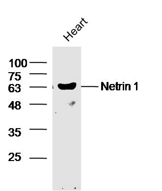 Mouse heart lysates probed with Rabbit Anti-Netrin 1 Polyclonal Antibody, Unconjugated (bs-1858R) at 1:300 overnight at 4˚C. Followed by a conjugated secondary antibody (bs-0295G-HRP) at 1:5000 for 90 min at 37˚C.