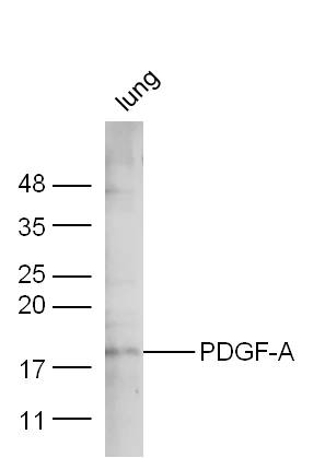 Mouse lung lysate probed with Anti-PDGF-A Polyclonal Antibody (bs-0196R) at 1:300 overnight in 4˚C. Followed by conjugation to the secondary antibody (bs-0295G-HRP) at 1:5000 90min in 37˚C.