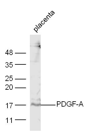 Mouse placenta lysate probed with Anti-PDGF-A Polyclonal Antibody (bs-0196R) at 1:300 overnight in 4˚C. Followed by conjugation to the secondary antibody (bs-0295G-HRP) at 1:5000 90min in 37˚C.