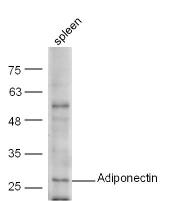 Mouse spleen lysate probed (bs-0471R) at 1:300 overnight in 4˚C. Followed by conjugation to the secondary antibody (bs-0295G-HRP) at 1:5000 90min in 37˚C.\n