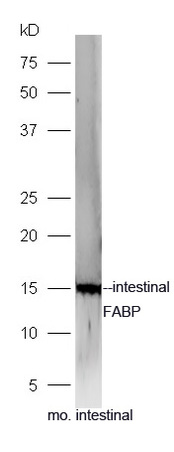 Mouse intestinal lysates probed with Rabbit Anti-FABP2 Polyclonal Antibody, Unconjugated (bs-0788R) at 1:300 overnight at 4˚C. Followed by a conjugated secondary antibody (bs-0295G-HRP) at 1:5000 for 90 min at 37˚C.