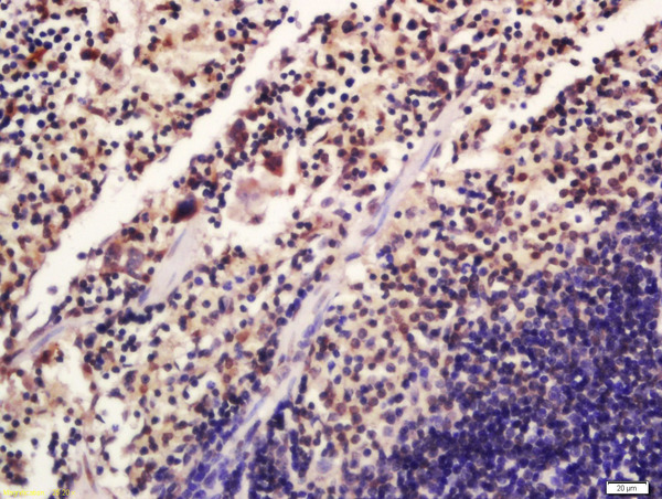 Formalin-fixed and paraffin embedded mouse spleen labeled with Rabbit Anti-SATB1 (Ser47) Polyclonal Antibody, Unconjugated(bs-3390R) 1:200 followed by conjugation to the secondary antibody and DAB staining