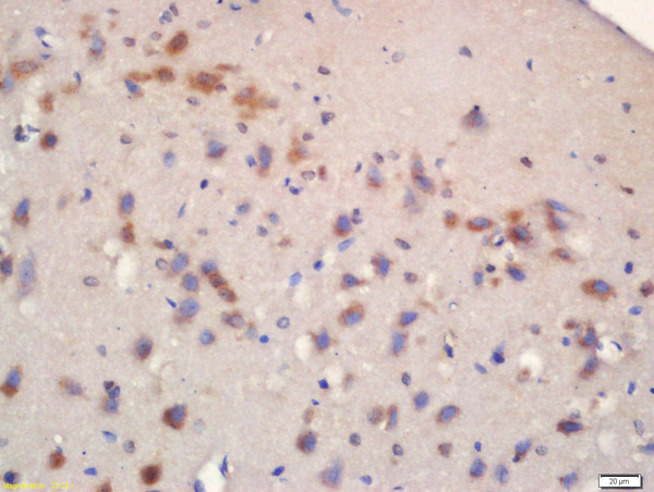 Formalin-fixed and paraffin embedded rat brain labeled with Rabbit Anti-mTOR (Ser2481) Polyclonal Antibody, Unconjugated(bs-3495R) 1:200 followed by conjugation to the secondary antibody and DAB staining\\n