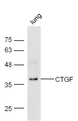 Mouse lung lysate probed with Anti-CTGF Polyclonal Antibody (bs-0743R) at 1:300 overnight in 4˚C. Followed by conjugation to the secondary antibody (bs-0295G-HRP) at 1:5000 90min in 37˚C.