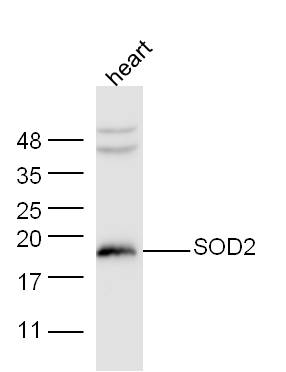 Mouase heart lysates probed with Anti-SOD2 Polyclonal Antibody(bs-1080R) at 1:300 overnight in 4˚C. Followed by conjugation to the secondary antibody (bs-0295G-HRP) at 1:5000 90min in 37˚C. Predicted and observed band size: 17kDa,33kD
