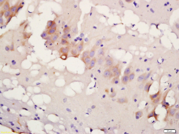 Formalin-fixed and paraffin embedded rat brain labeled with Rabbit Anti-TBK1 (Ser172) Polyclonal Antibody, Unconjugated(bs-3440R) 1:200 followed by conjugation to the secondary antibody and DAB staining Formalin-fixed and paraffin embedded rat brain labeled with Rabbit Anti-TBK1 (Ser172) Polyclonal Antibody, Unconjugated(bs-3440R) 1:200 followed by conjugation to the secondary antibody and DAB staining
