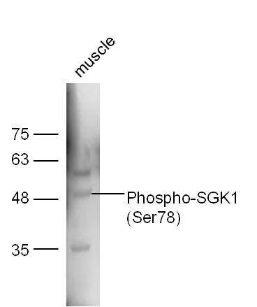 Mouse muscle lysates probed with Rabbit Anti-SGK1 (Ser78) Polyclonal Antibody, Unconjugated (bs-3395R) at 1:300 overnight at 4˚C. Followed by conjugation to secondary antibody (bs-0295G-HRP) at 1:5000 for 90 min at 37˚C.