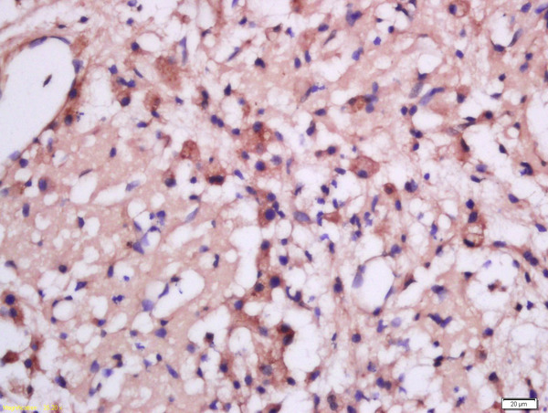 Formalin-fixed and paraffin embedded rat brain tissue labeled with Anti-MSRB2 Polyclonal Antibody, Unconjugated (bs-17861R) at 1:300 followed by conjugation to the secondary antibody and DAB staining