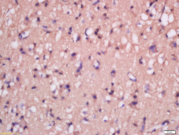Formalin-fixed and paraffin embedded rat brain tissue labeled with Anti-MSRB2 Polyclonal Antibody, Unconjugated (bs-17861R) at 1:300 followed by conjugation to the secondary antibody and DAB staining