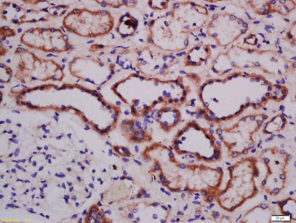 Formalin-fixed and paraffin embedded human kidney labeled with Anti-ATG101 Polyclonal Antibody, Unconjugated (bs-20220R) at 1:300 followed by conjugation to the secondary antibody and DAB staining.