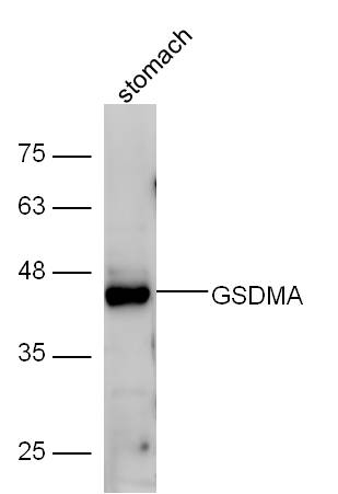 Mouse stomach lysate probed with Anti-GSDMA Polyclonal Antibody, Unconjugated (bs-16331R) at 1:300 overnight at 4˚C. Followed by conjugation to secondary antibody (bs-0295G-HRP) at 1:5000 for 90 min at 37˚C. Mouse stomach lysate probed with Anti-GSDMA Polyclonal Antibody, Unconjugated (bs-16331R) at 1:300 overnight at 4˚C. Followed by conjugation to secondary antibody (bs-0295G-HRP) at 1:5000 for 90 min at 37˚C.