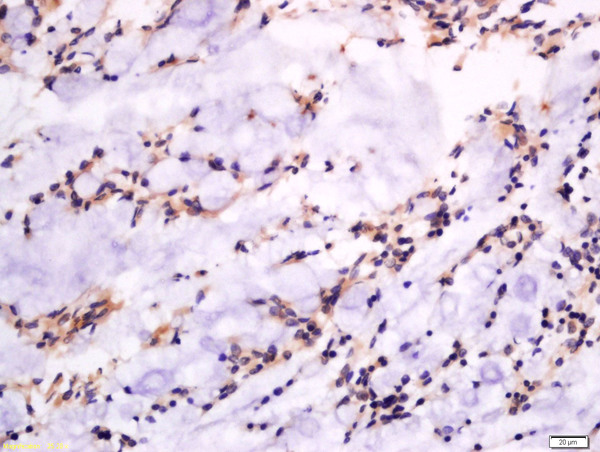 Formalin-fixed and paraffin embedded rat rectum labeled with Anti-GSDMA Polyclonal Antibody, Unconjugated (bs-16331R) at 1:300 followed by conjugation to the secondary antibody and DAB staining. Formalin-fixed and paraffin embedded rat rectum labeled with Anti-GSDMA Polyclonal Antibody, Unconjugated (bs-16331R) at 1:300 followed by conjugation to the secondary antibody and DAB staining.
