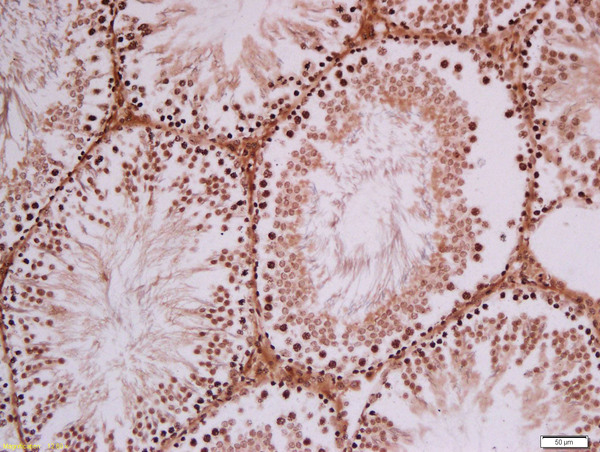 Formalin-fixed and paraffin embedded rat testis tissue labeled with Rabbit Anti-FAM120C Polyclonal Antibody, Unconjugated (bs-6810R) at 1:200 followed by conjugation to the secondary antibody and DAB staining