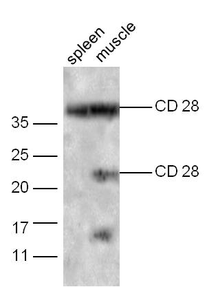 Mouse spleen probed with Rabbit Anti-CD28 Polyclonal Antibody Unconjugated (bs-8865R) at 1:300 overnight at 4˚C. Followed by conjugation to secondary antibody (bs-0295G-HRP) at 1:5000 for 90 min at 37˚C.\\n
