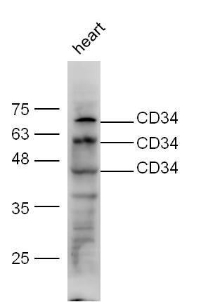 Mouse heart lysate probed with Anti-CD34 Polyclonal Antibody, Unconjugated (bs-8996R) at 1:300 overnight at 4˚C. Followed by conjugation to secondary antibody (bs-0295G-HRP) at 1:5000 for 90 min at 37˚C.\\n