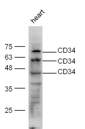 Mouse heart lysate probed with Anti-CD34 Polyclonal Antibody, Unconjugated (bs-8996R) at 1:300 overnight at 4˚C. Followed by conjugation to secondary antibody (bs-0295G-HRP) at 1:5000 for 90 min at 37˚C.\n