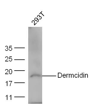 293T cell lysates probed with Anti-Dermcidin/DCD Polyclonal Antibody, Unconjugated (bs-12996R) at 1:300 overnight at 4˚C. Followed by conjugation to secondary antibody (bs-0295G-HRP) at 1:5000 for 90 min at 37˚C.\n