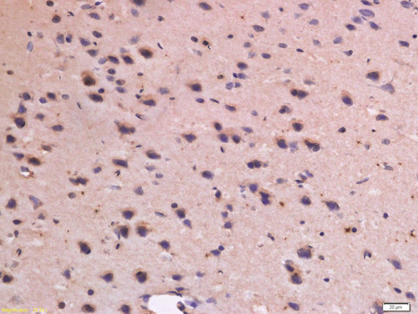 Formalin-fixed and paraffin embedded rat brain labeled with Anti-CD31 Polyclonal Antibody, Unconjugated (bs-0468R) at 1:300 followed by conjugation to the secondary antibody and DAB staining.